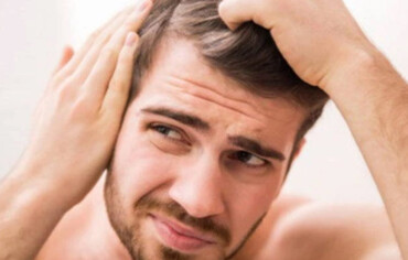 Going Bald Too Young? Top Tips From The Experts!